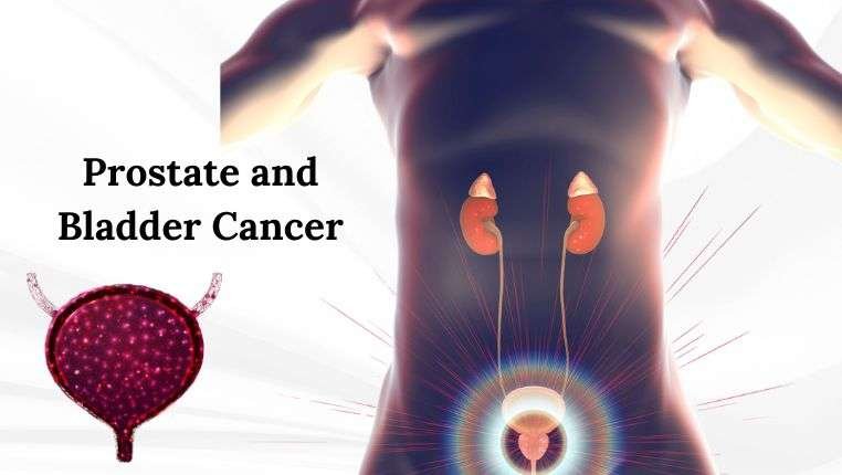 Prostate and Bladder Cancer