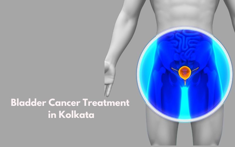 Bladder Cancer Treatment in Kolkata