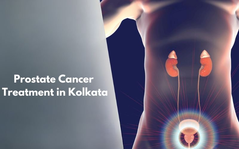 Prostate Cancer Treatment in Kolkata