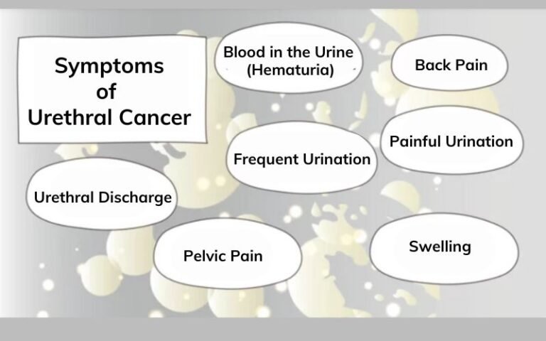 urethral cancer treatment