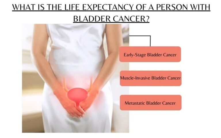 Bladder Cancer Treatment