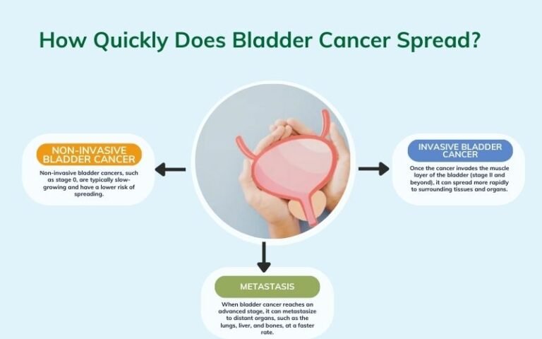 Bladder Cancer Treatment