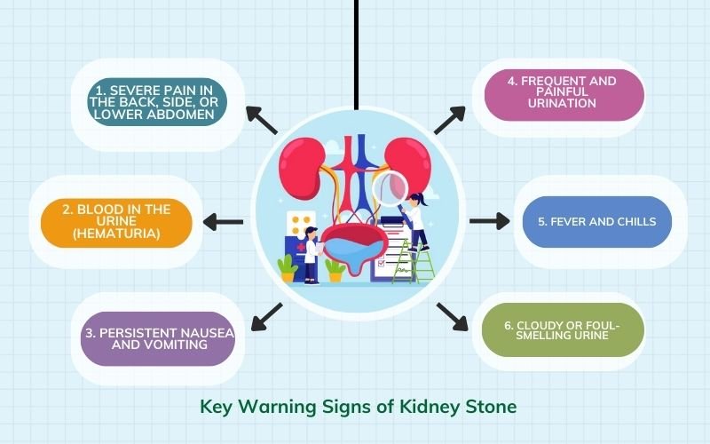 Kidney Stone Specialist