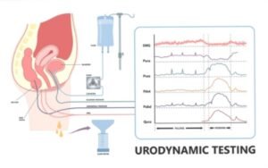 Urodynamic Studies