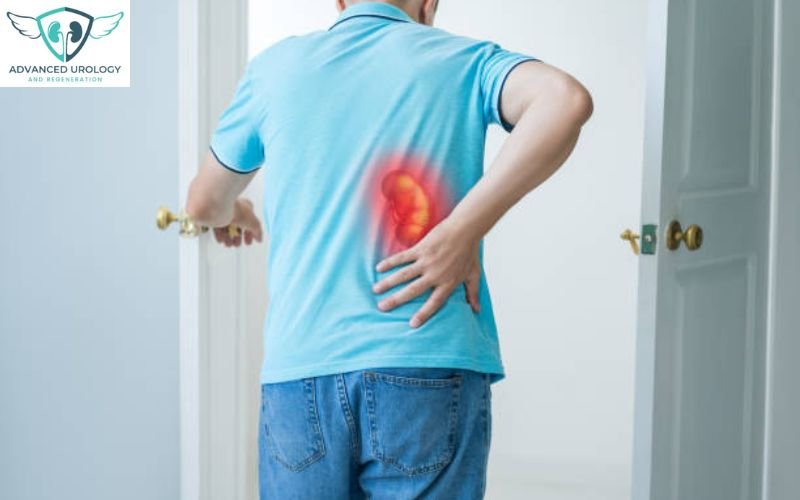 Kidney Stones Symptoms