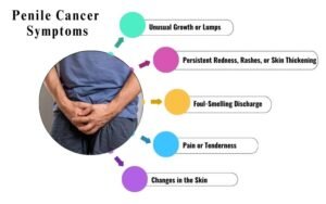 Penile Cancer Symptoms